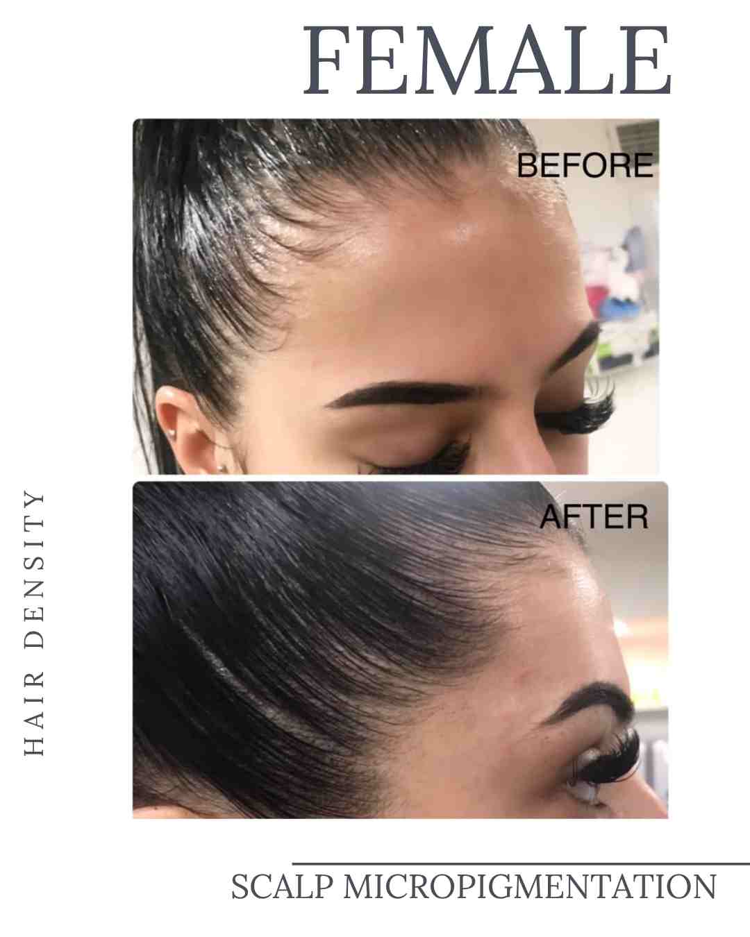 Female scalp micropigmentation training course at Institute of Ink Brisbane