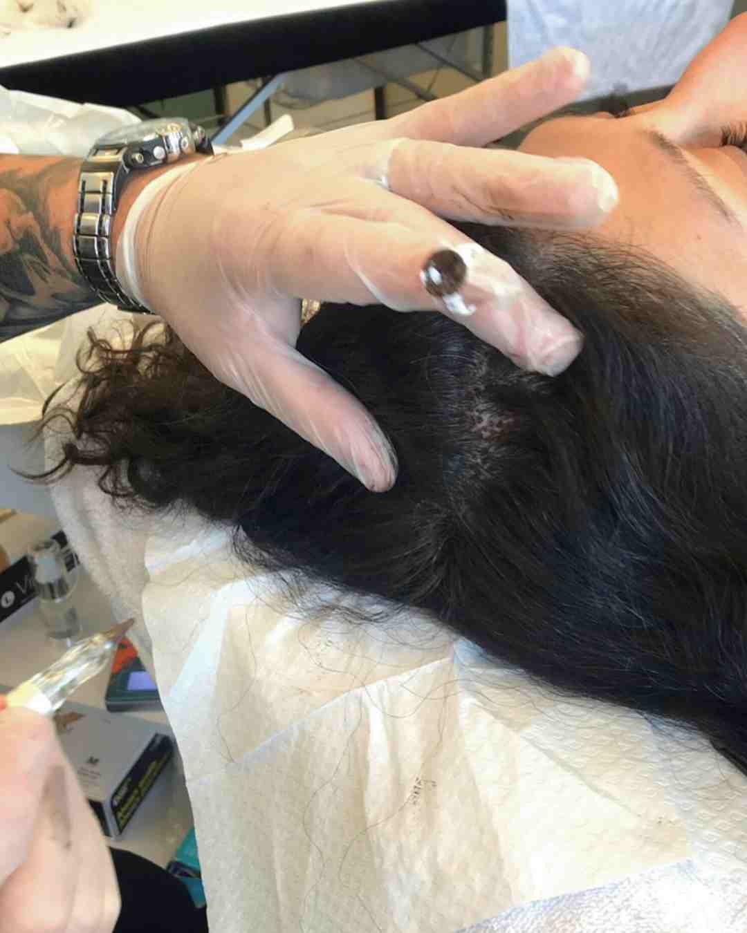 Hands-on scalp micropigmentation student training at Institute of Ink Brisbane